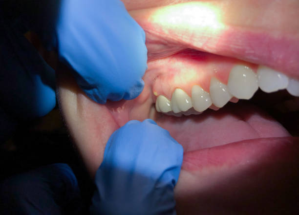 Best Walk-In Emergency Dental Services in Sprague, WV