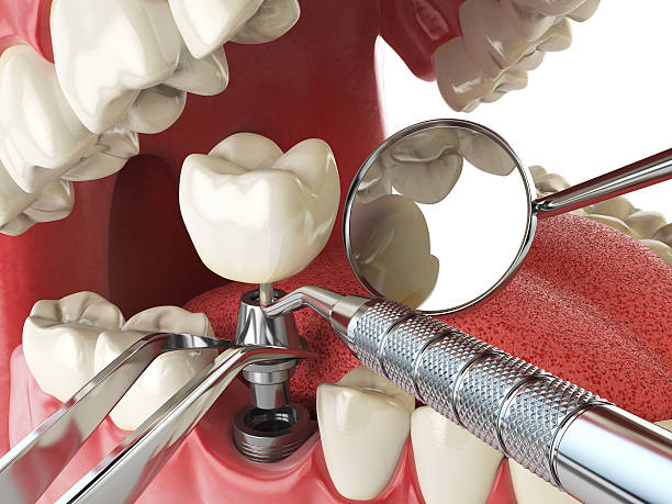 Best Emergency Denture Repair in Sprague, WV